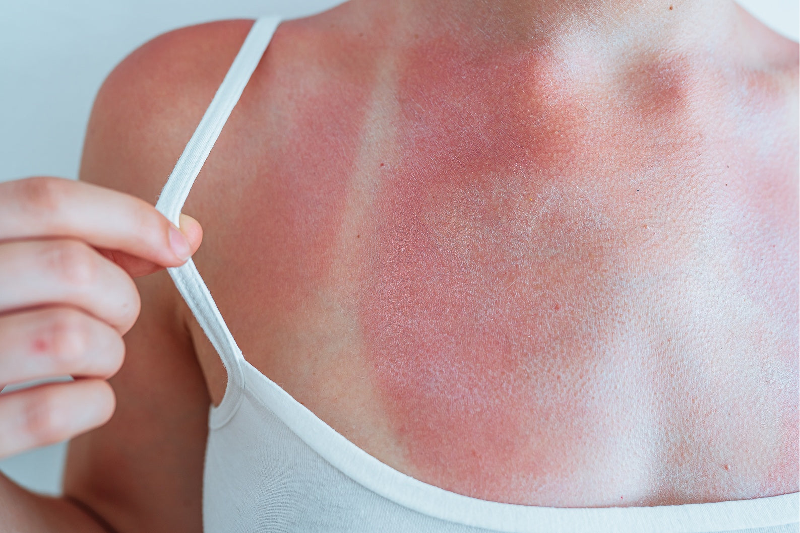 Sonnenbrand verhindern, Zellschutz von Innen
